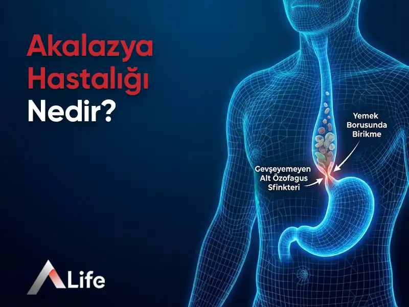 Akalazya Hastalığı Nedir? | Akalazya Hastalığı Neden Olur?
